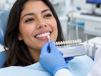 Comparación del tono dental con una guía de colores